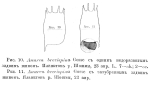 Keratella hiemalis