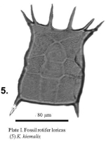 Keratella hiemalis