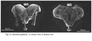 Keratella quadrata