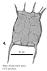 Keratella quadrata