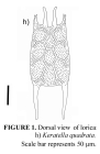 Keratella quadrata