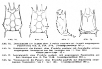 Keratella quadrata f. klementi