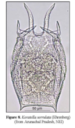 Keratella serrulata