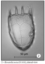 Keratella tecta