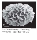 Keratella valga