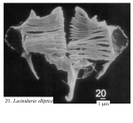 Lacinularia elliptica