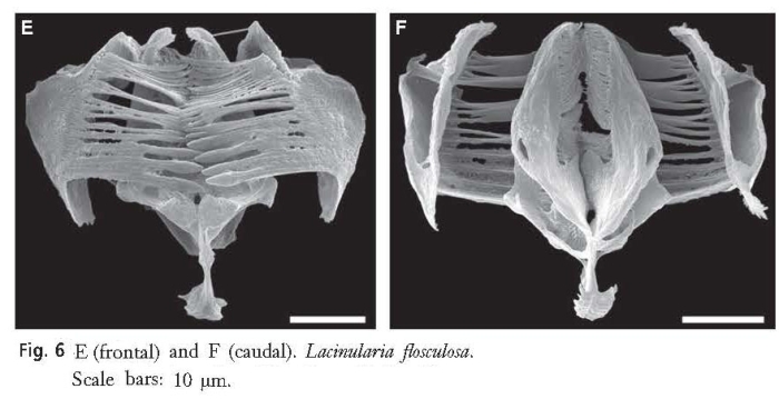 Lacinularia flosculosa Lacinularia flosculosa