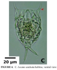 Lecane aculeata