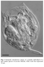 Lecane closterocerca