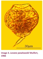 Lecane closterocerca