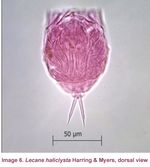 Lecane haliclysta