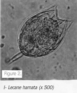 Lecane hamata