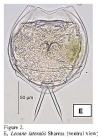 Lecane lateralis