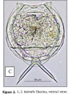 Lecane lateralis