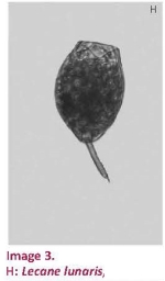Lecane lunaris