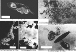 Lecane rhacois