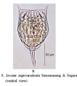 Lecane superaculeata