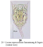 Lecane superaculeata