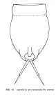 Lecane tenuiseta