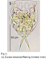 Lecane tenuiseta