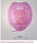 Lecane unguitata