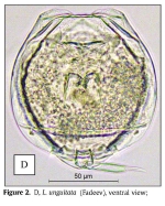 Lecane unguitata