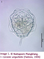 Lecane unguitata