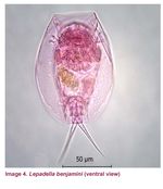 Lepadella benjamini