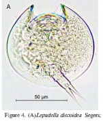 Lepadella discoidea