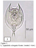 Lepadella elongata