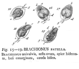 Lepadella patella