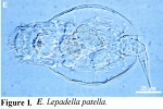 Lepadella patella