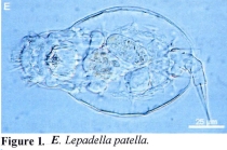 Lepadella patella