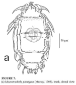 Macrotrachela pinnigera