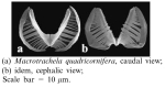 Macrotrachela quadricornifera