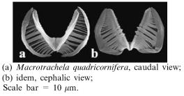Macrotrachela quadricornifera