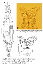 Macrotrachela quadricornifera