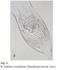 Notholca acuminata