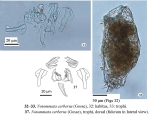 Notommata cerberus