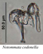 Notommata codonella