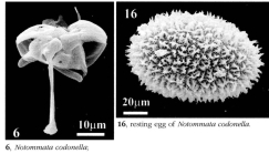 Notommata codonella