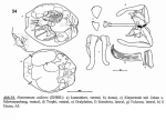 Notommata collaris