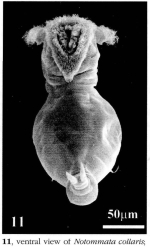 Notommata collaris