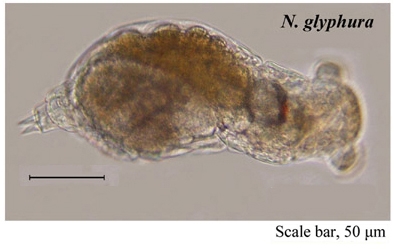 Notommata glyphura Notommata glyphura