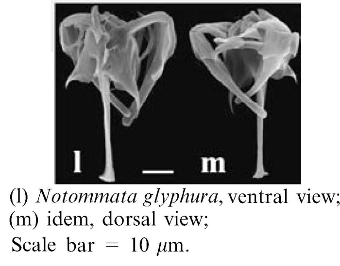 Notommata glyphura Notommata glyphura