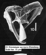 Notommata saccigera