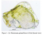 Notommata spinata