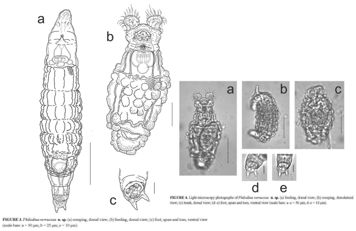 Philodina verrucosa Philodina verrucosa