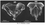 Plationus patulus
