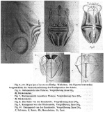 Ploesoma lenticulare